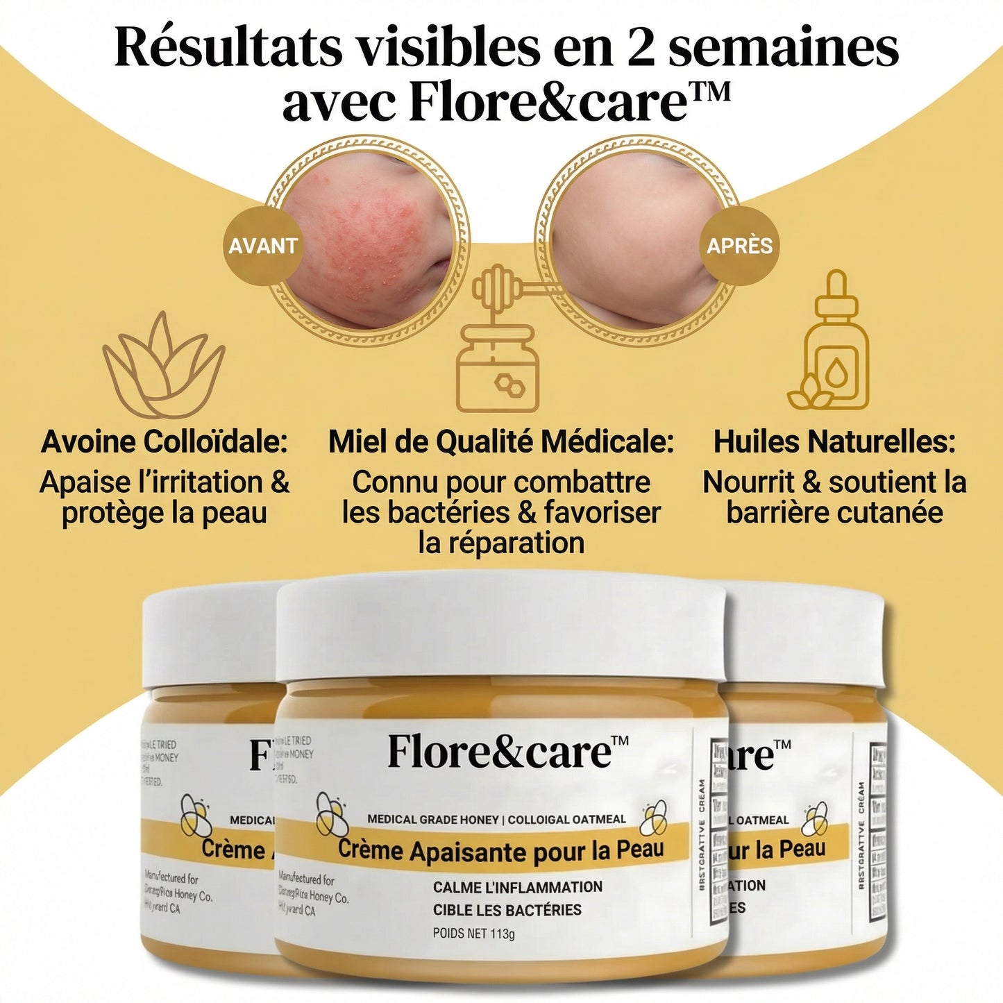 DermaCalm Bébé™ – Crème Réparatrice Intense