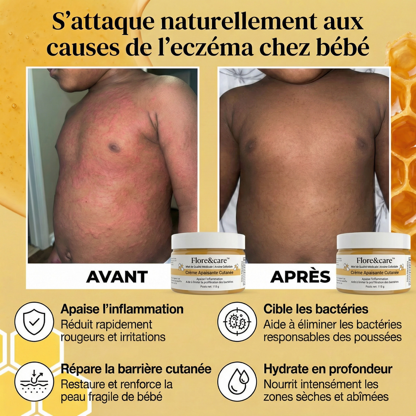 DermaCalm Bébé™ – Crème Réparatrice Intense