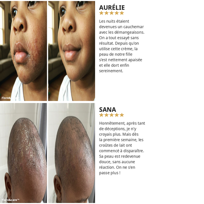 DermaCalm Bébé™ – Crème Réparatrice Intense