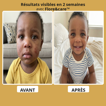 DermaCalm Bébé™ – Crème Réparatrice Intense