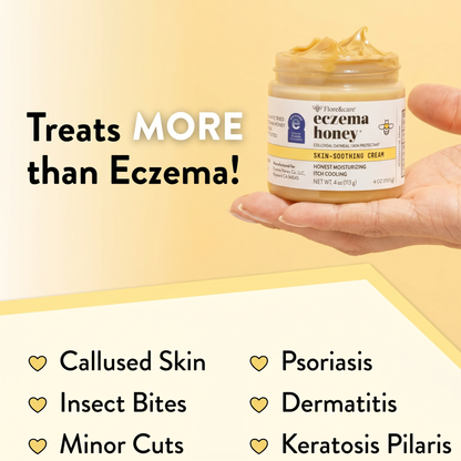 Eczema Honey Original Skin-Soothing Cream