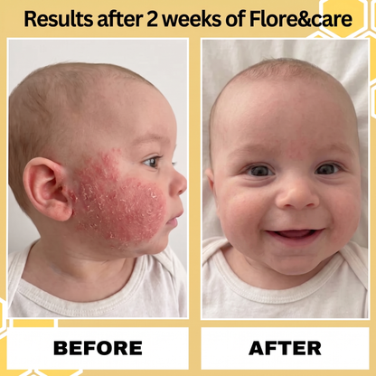 Eczema Honey Original Skin-Soothing Cream