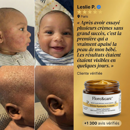 DermaCalm Bébé™ – Crème Réparatrice Intense